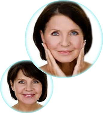 Before & After Chemical Peel Before & After Chemical Peel