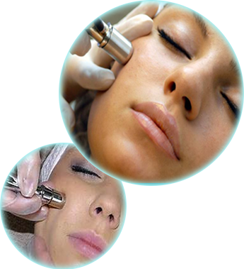 Microdermabrasion Treatment in Sun City West, AZ Microdermabrasion Treatment in Sun City West, AZ