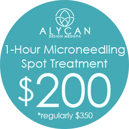 1-Hour Microneedling Spot Treatment $200  *Regularly $350